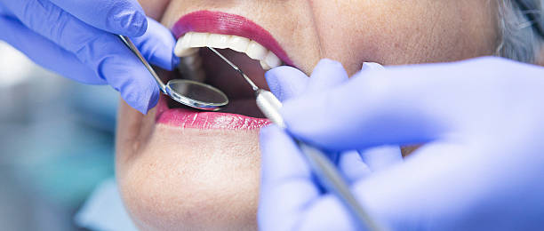Best Emergency Tooth Extraction in Dunlap, OH